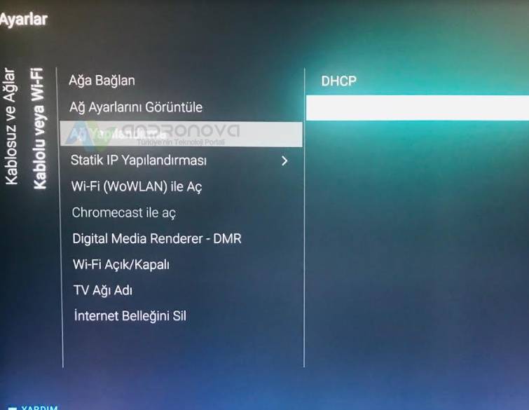 Philips TV DNS IP bağlanmıyor